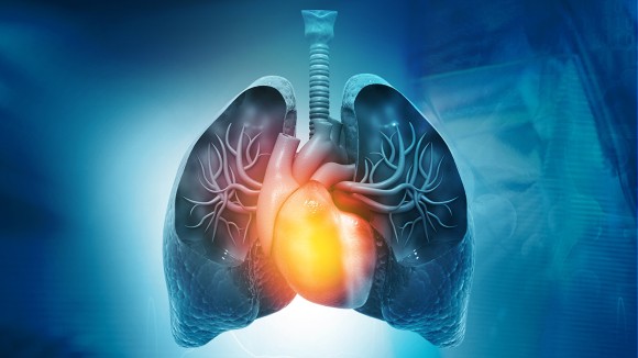 Pulmonary Arterial Hypertension Market to Rise to 14785.47 Mn